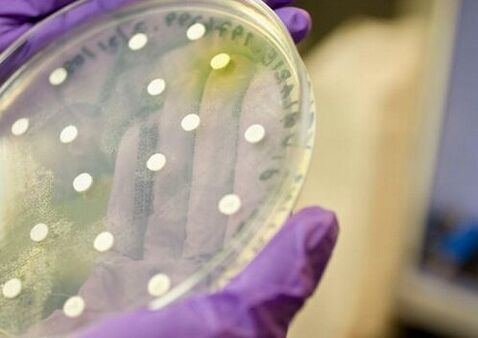 bacterial culture for the diagnosis of prostatitis